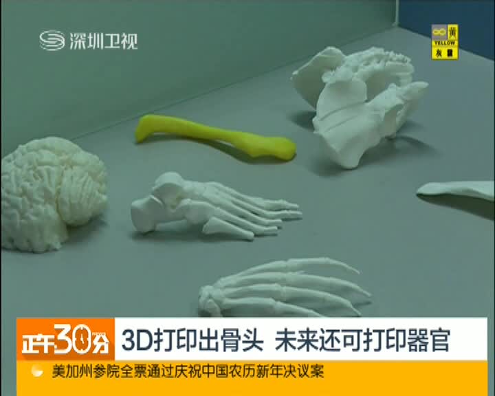 3d打印出骨头 未来还可以打印器官 搜狐视频