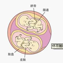 双胞胎是怎样形成的?双胞胎儿发育过程图