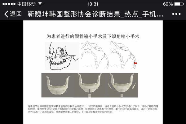 现代爰国的事例