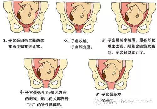 生娃全过程,让你清楚生宝宝该如何配合医生!