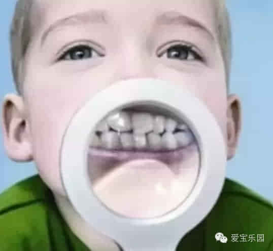 孩子换牙,长出的牙齿很丑、不整齐怎么办?
