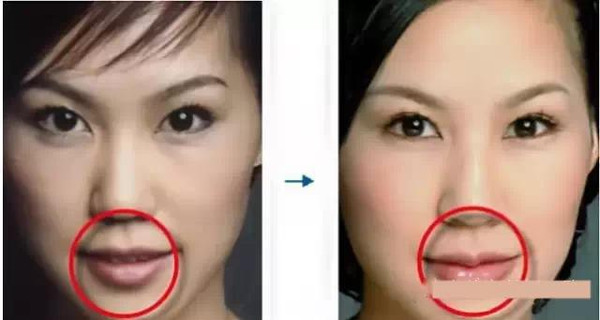 美女新标志:卧蚕 唇珠 美人尖 腰窝