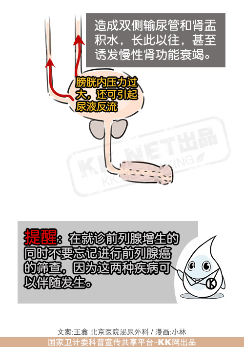 【图文解说】中老年男性应警惕前列腺增生-36-50岁中年爸爸的烦恼