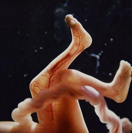 怀孕16周胎儿图