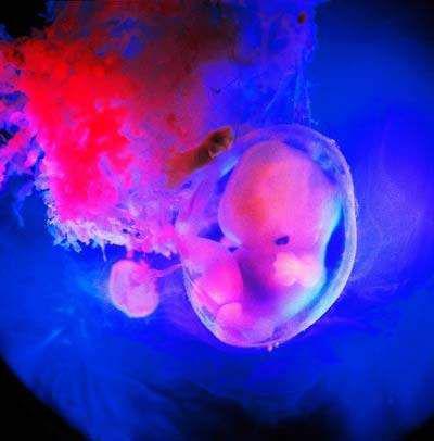 揭秘!胎儿性别形成过程,精子表现好精彩