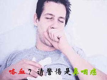 鼻咽癌的早期症状表现