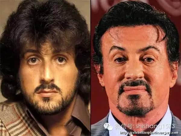 1 西尔维斯特·史泰龙(sylvester stallone)怎么看就是怪怪的啊!