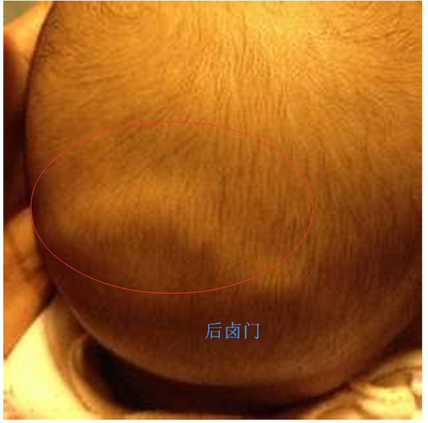 新生宝宝护理:宝宝头上的囟门护理知多少