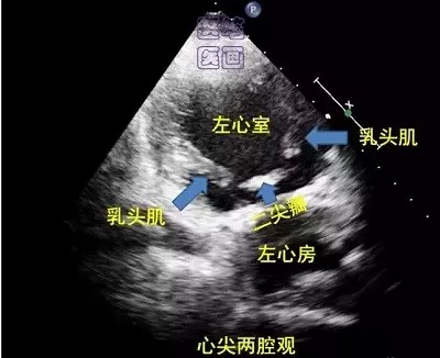 实用最萌心脏超声入门图谱