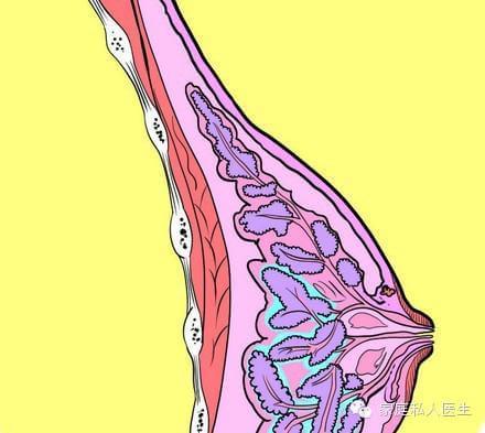 乳腺囊性增生:囊性增生比单纯的增生更为严重一些,不仅仅是腺体的