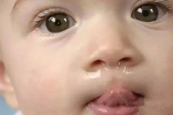 宝宝七个月流鼻涕怎么办