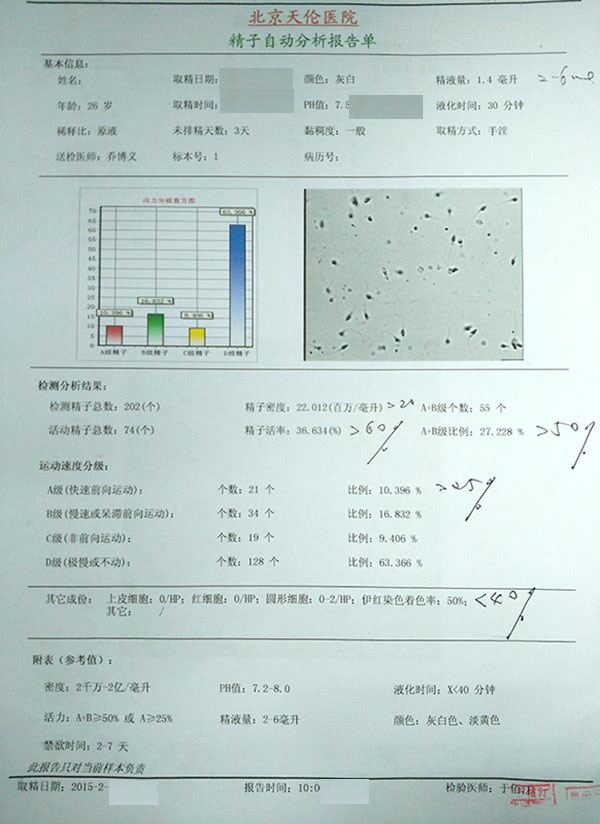 北京天伦不孕不育医院精子自动分析报告