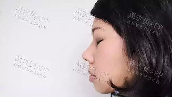 这个是她分别佩戴各种size的侧脸效果.
