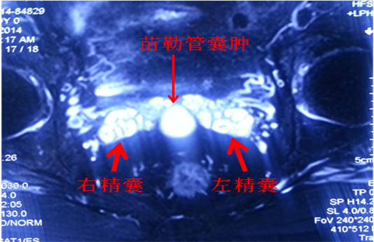 精血怎么办