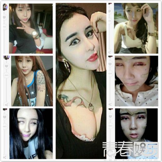 15岁少女为情整容 李蒽熙显赫背景曝光竟然与王思聪有关?