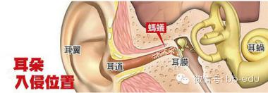 耳朵进了蚂蚁怎么办