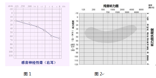 惠耳听力科普讲堂声音的秘密