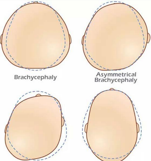 一个小宝宝头型塑造全程揭秘