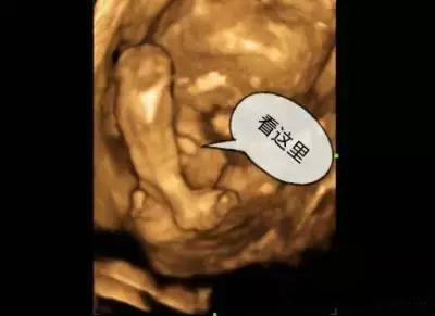 怀孕4个月照的彩超,真的就可以看出宝贝的性别