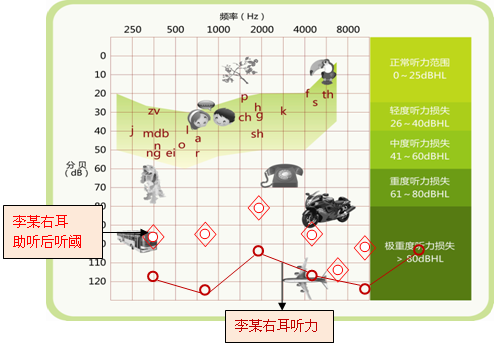郴州惠耳提醒您:听损孩子发音不好,助听器很关键