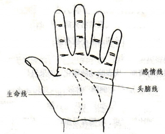 是走在手掌中间止于小鱼际上的一条线,只要是弱智,痴呆的人,这条纹