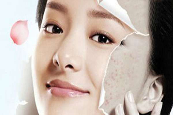 为什么护肤先要排毒-搜狐