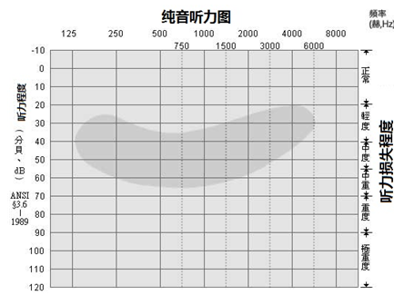 助听器验配中如何正确看待香蕉图?---萧山 惠耳