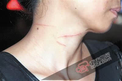 贾文轩的脖子被刀划伤几条小口子.