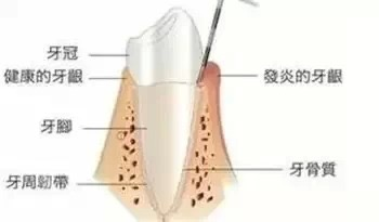 板牙疼怎么办