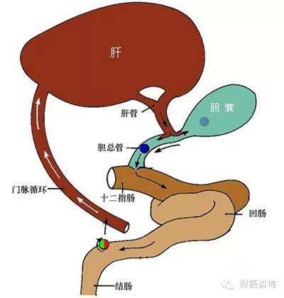 湿热体质如何调理?-搜狐