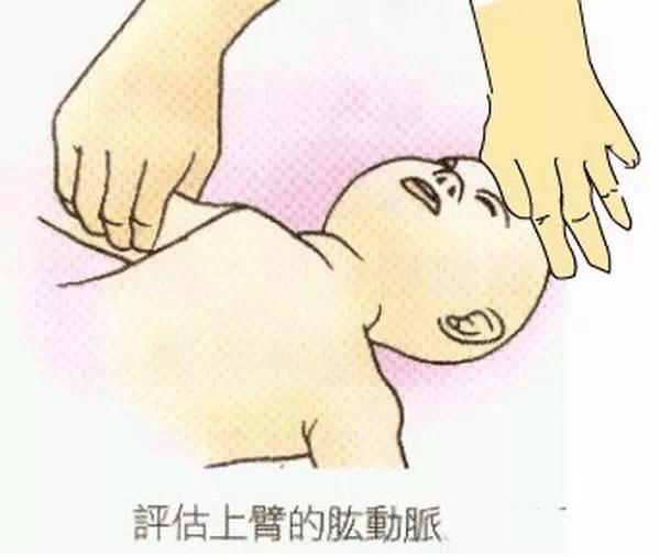 step:给宝宝做30次胸外心脏按压.