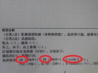 pr(孕激素受体)her2(又称人表皮生长因子受体-2)是乳腺癌患者病理报告