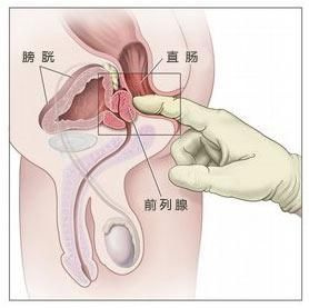 外生殖器检查：外生殖器往往无异常表现。