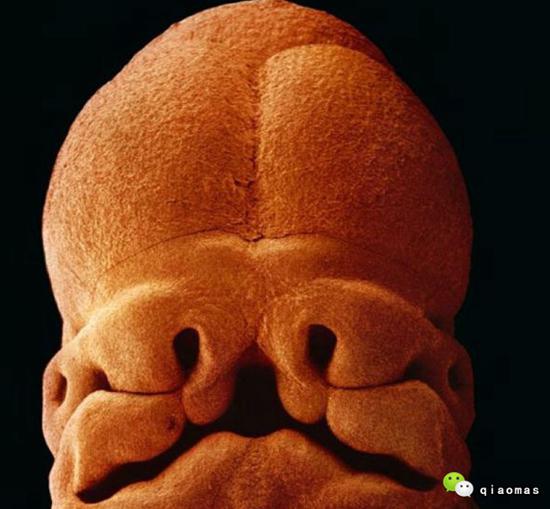 震撼罕见图!显微镜实拍胎儿成长全过程!