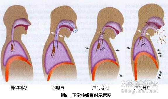 咳嗽莫大意 背后有玄机