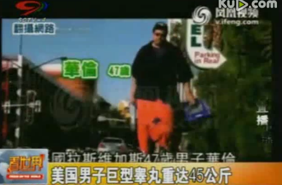 男子巨型睾丸重45公斤