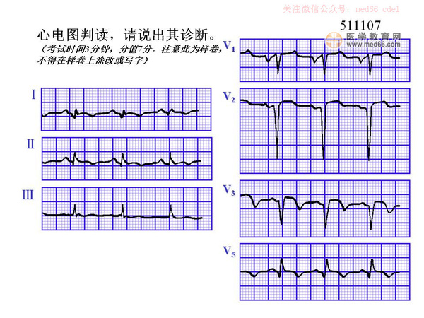 执业医师实践技能考试心电图记忆口诀