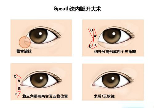 什么眦什么裂成语_眦读什么(3)