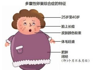 多囊卵巢综合症(pcos)与肥胖