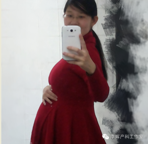 孕34周,各项检查都正常哒自己