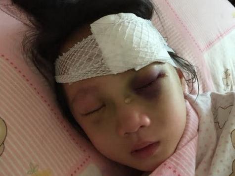 8岁女童电梯内遭熊孩子暴打,伤势惨不忍睹