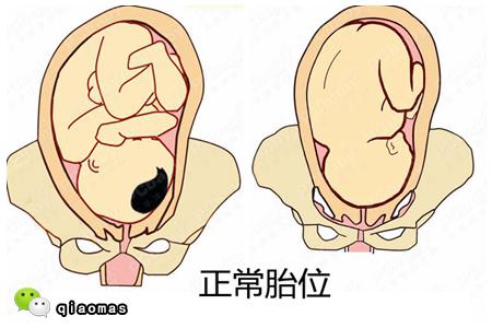 你肚子里的宝宝胎位正吗?快拿出b超单看看吧