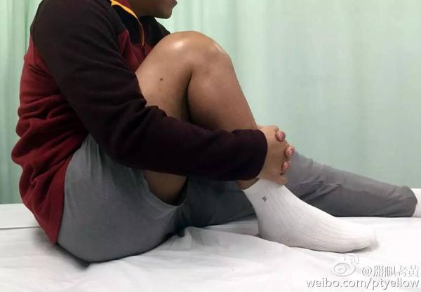 当角度更大时可以通过坐位抱腿的方法达到接近120度的角度.
