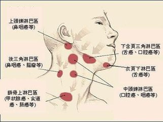 淋巴瘤疾病的病因有什么?