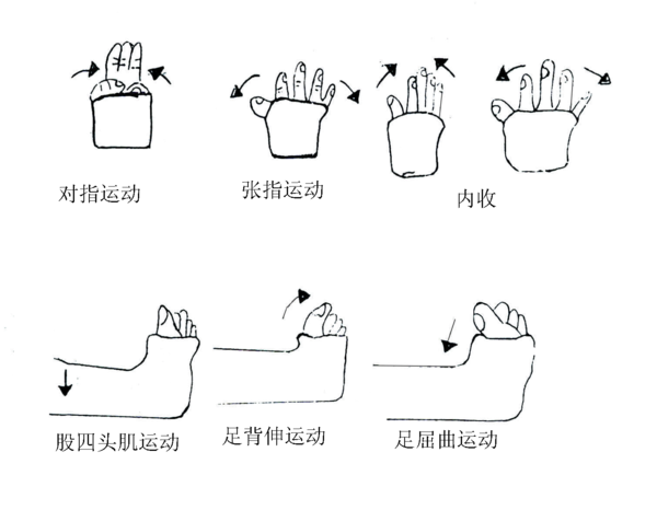 经常运动不受支具限制的关节,如手指或脚趾,以助减少肿胀及保持灵活性