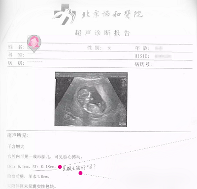 妇产科 产科 孕前检查   贴心提示:     产检的作用:及时了解孕期母婴