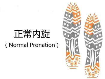 低足弓(扁平足)跑者往往会出现过度内旋的情况