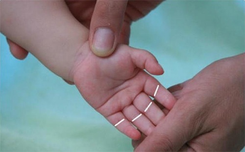 母婴 正文  位置:手掌面,食,中,无名,小指第一指间关节横纹处.