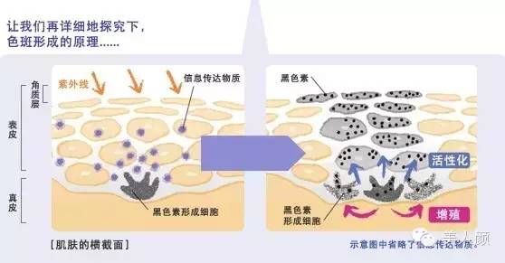 激光祛斑!经典6问-搜狐