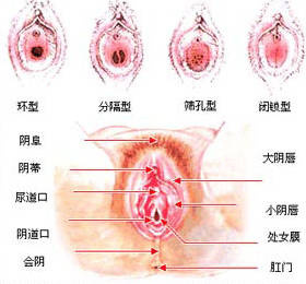 北京不孕不育医院谈阴道炎的症状与诊断